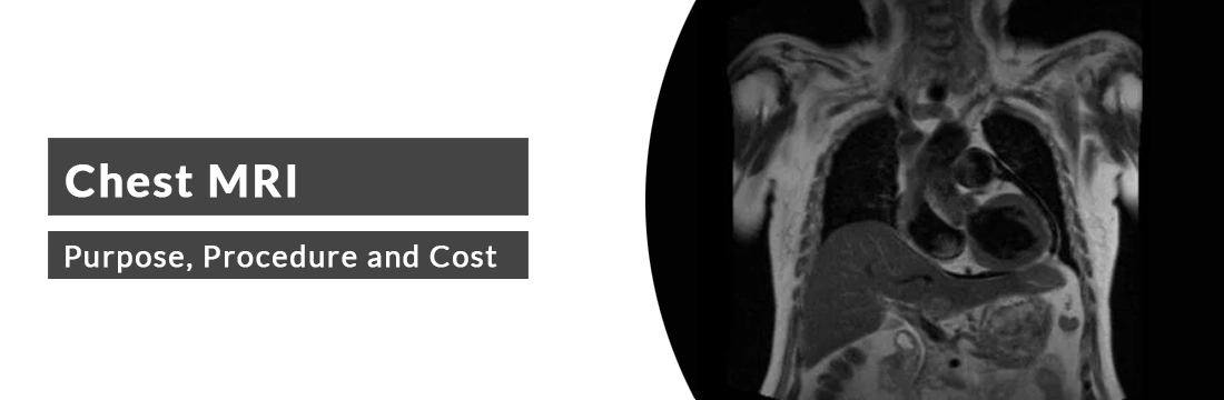 Chest MRI: Purpose, Procedure, Cost and Best MRI Centre